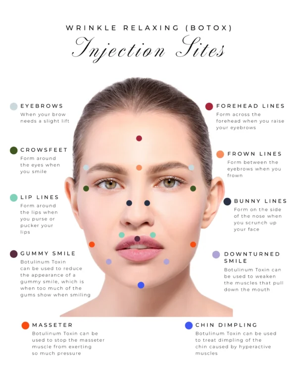 Botox (50IU/100IU/200IU) Injection