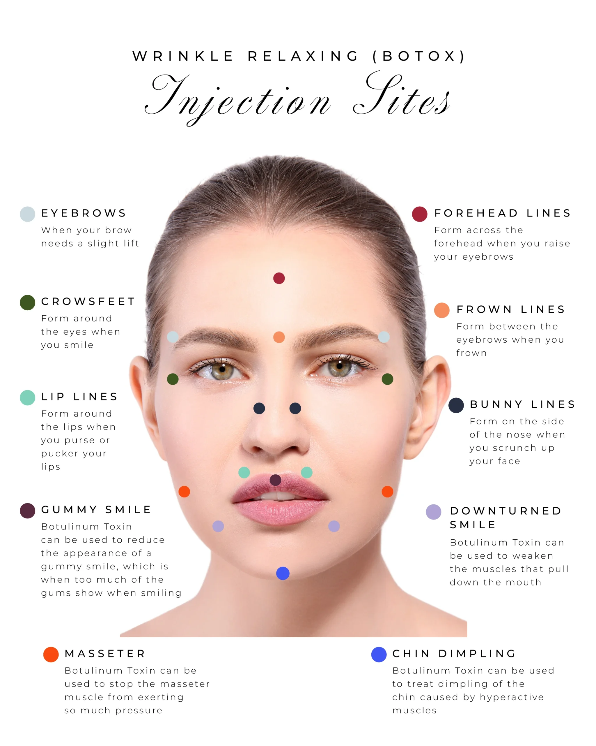 Botox (50IU/100IU/200IU) Injection Botox (50IU/100IU/200IU) Injection