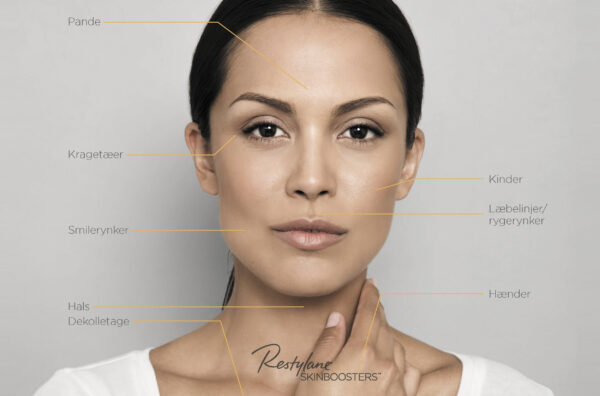 Restylane (Contour, Defyne, Kysse, Lyft, Refyne, Silk, Eyelight, L)