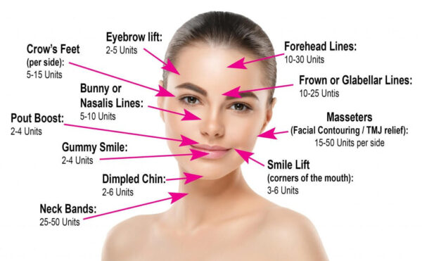Botox (50IU/100IU/200IU) Injection