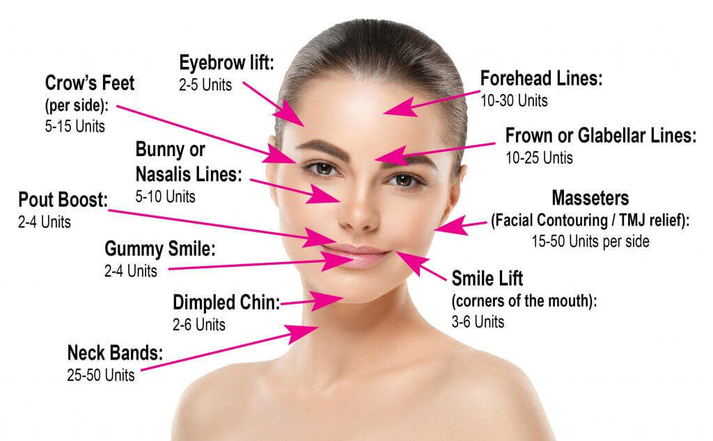 Botox (50IU/100IU/200IU) Injection Botox (50IU/100IU/200IU) Injection